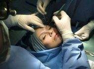 رازهای سری جراحان پلاستیک که به کسی نمی گویند