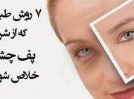 دلیل بوجود آمدن پف چشم و راه های رفع آن