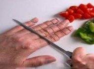 فوریت های پزشکی لازم هنگام قطع انگشت