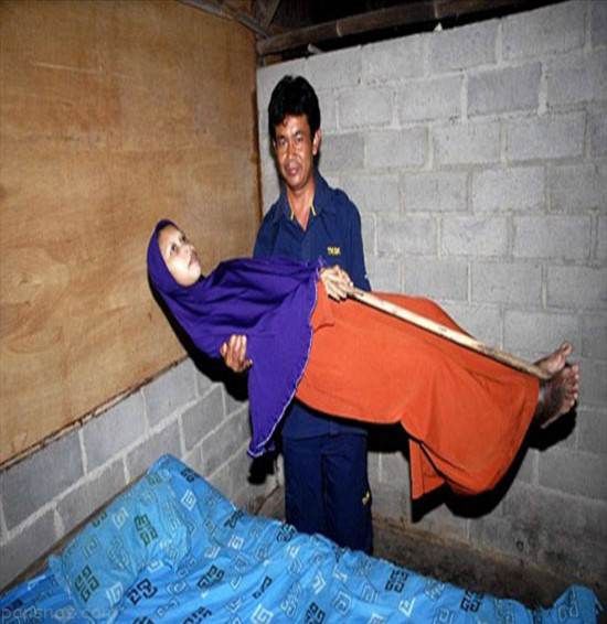 این زن مانند یک تکه چوب کاملا خشک شد