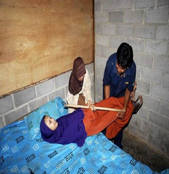 این زن مانند یک تکه چوب کاملا خشک شد