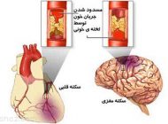 بهترین روش ها برای مقابله با سکته قلبی