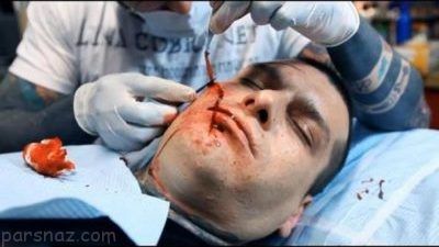 انجام عمل جراحی برای ترسناک شدن قیافه +عکس