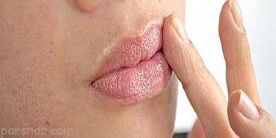 بهترین روش های رفع خشکی لب در هوای سرد