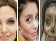 عکس های عروس مردگان ایرانی قبل از عمل جراحی