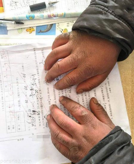 کودکی که در راه مدرسه یخ زد و منجمد شد +عکس
