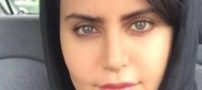 آیا الناز شاکردوست واقعا ضربه مغزی شده؟ شایعه یا واقعیت