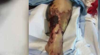 این زن با خوردن غذای لاکچری جان خود را از دست داد