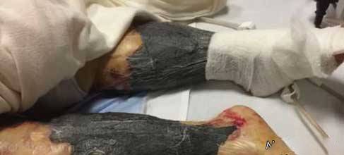 این زن با خوردن غذای لاکچری جان خود را از دست داد