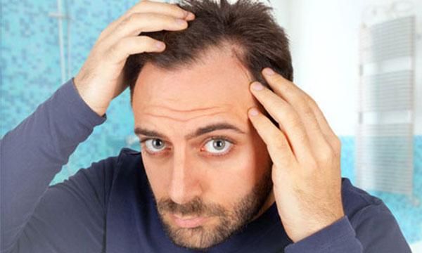 روش تهیه بهترین شامپو برای موهای خشک (شامپو مناسب مو خشک)