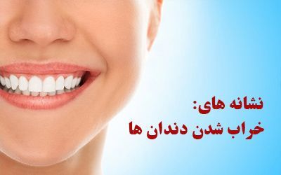 نشانه های خرابی دندان ها | از بوی بد دهان تا سفید شدن زبان