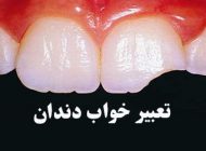 تعبیر خواب دندان | دیدن دندان سالم یا پوسیده در خواب چه معنایی دارد؟