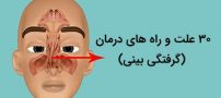 علل و راه های درمان گرفتگی بینی (10 روش خانگی موثر)