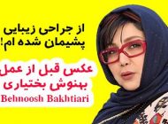 عکس بهنوش بختیاری قبل از عمل بینی ! + توضیحات