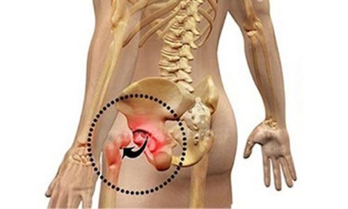 معرفی جراح مفصل ران