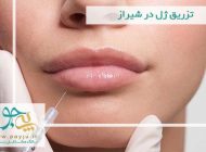 همه چیز درباره تزریق ژل و بوتاکس
