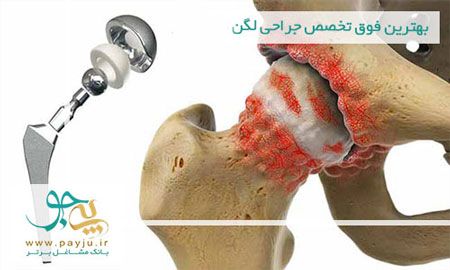 معرفی جراح مفصل ران