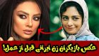 عکس بازیگران زن ایرانی قبل و بعد از عمل زیبایی + توضیحات