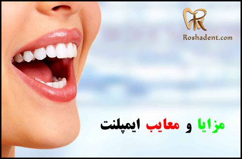 اول ایمپلنت یا ارتودنسی