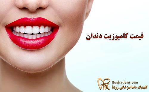 بهترین روش دندانپزشکی زیبایی