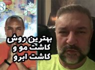 بهترین روش کاشت مو و کاشت ابرو در کلینیک ساعی