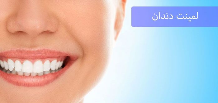 بهترین روش دندانپزشکی زیبایی