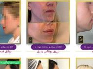 لاغری سریع بدون ورزش + موثرترین راهکار ها