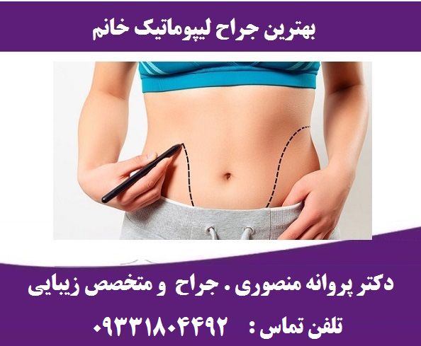 هزینه لیپوماتیک شکم و پهلو سال 1401