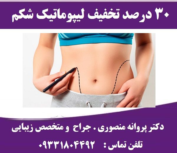 هزینه لیپوماتیک شکم و پهلو سال 1401