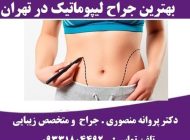 هزینه لیپوماتیک شکم و پهلو سال 1401