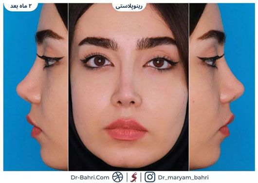 چطور بهترین جراح بینی در تهران را انتخاب کنیم؟