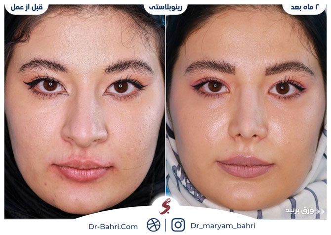 چطور بهترین جراح بینی در تهران را انتخاب کنیم؟