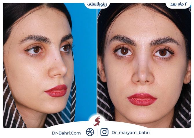 چطور بهترین جراح بینی در تهران را انتخاب کنیم؟