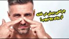 مرد برزیلی بینی خودش را در خانه جراحی کرد!