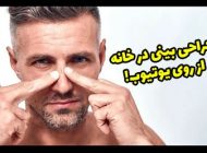 مرد برزیلی بینی خودش را در خانه جراحی کرد!