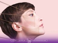 با لیفت نخ بدون جراحی به ظاهری جوان برسید
