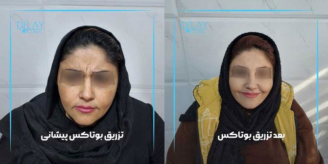 خدمات مرکز مشاوره پوست و مو دیلای