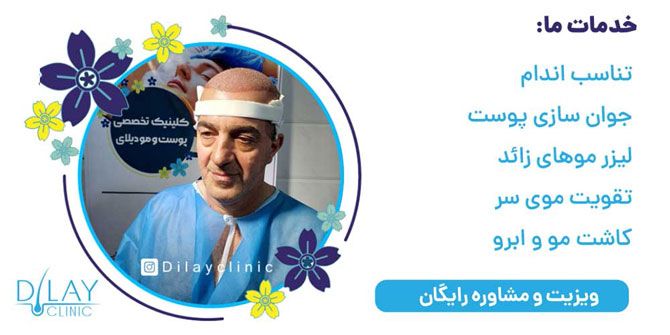 خدمات مرکز مشاوره پوست و مو دیلای