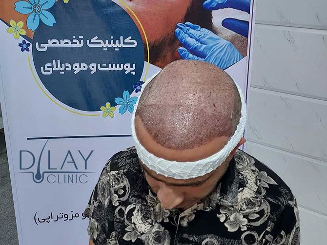 خدمات مرکز مشاوره پوست و مو دیلای