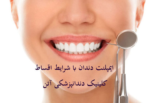 بهترین مرکز ایمپلنت دندان