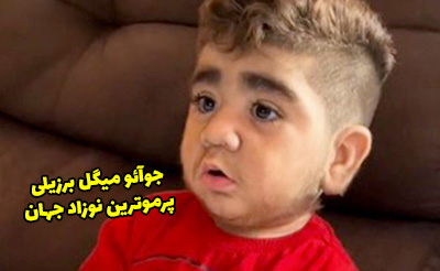 عکس نوزاد پرموی برزیلی که در تیک تاک معروف شده است!