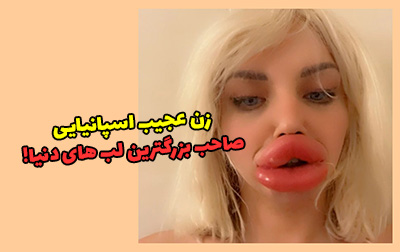 بزرگ ترین لب های دنیا متعلق به این زن اسپانیایی است! + عکس
