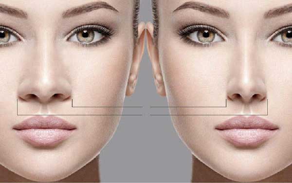بهترین جراح زیبایی بینی