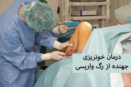 خونریزی جهنده از رگ واریس را چگونه درمان کنیم؟