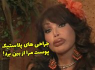 افراط در جراحی پلاستیک پوست این زن را از بین برده است + عکس