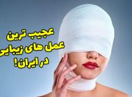 عمل های زیبایی عجیب در ایران که در بین جوانان رواج پیدا کرده است!
