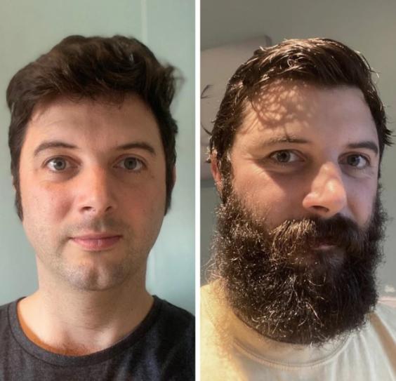 تاثیر ریش روی صورت