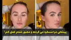 جراحی پلاستیک به خاطر بزرگ بودن پیشانی و تمسخر اطرافیان!