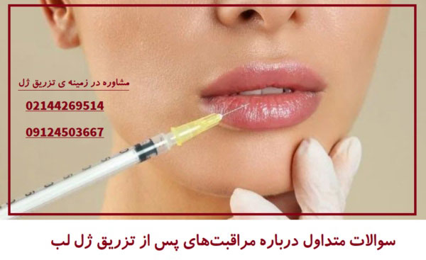 تزریق ژل لب و برندهای پرطرفدار آن