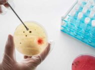 بعد از hpv مثبت چه اقداماتی باید انجام داد ؟